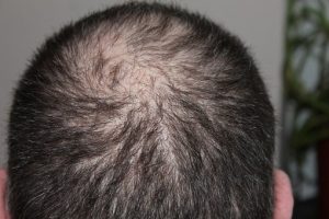 Cafeïne shampoo