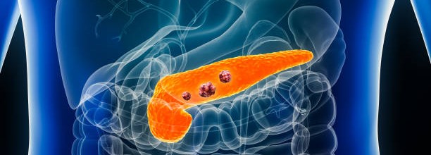 Gezonde pancreas anatomie en preventie